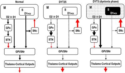 A dual dopaminergic therapy with L-3,4-dihydroxyphenylalanine and chlorpromazine for the treatment of blepharospasm, a focal dystonia: Possible implications for striosomal D1 signaling